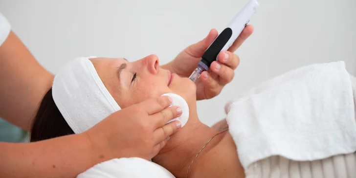 Účinná mezoterapia mezopenom v SKINSTUDIO