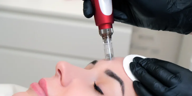 Mezoterapia tváre pre pevnú a pružnú pokožku
