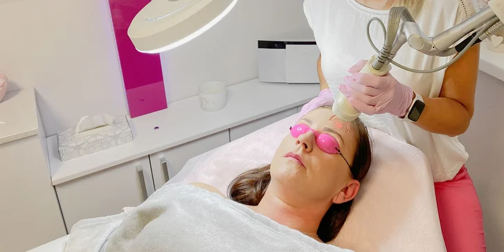Omladenie frakčným CO2 laserom alebo revolučným Gynolaserom
