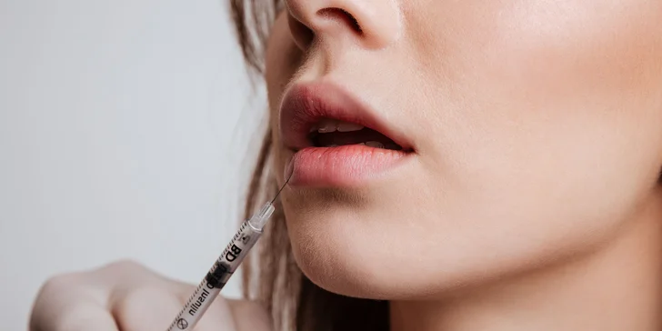 Zväčšenie pier výplňou Princess® Filler alebo Princess® Volume