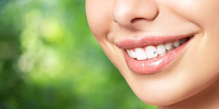 Profesionálne bielenie zubov či aplikácia zubného šperku Swarovski