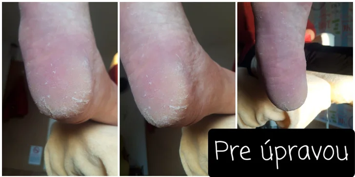 Suchá, mokrá alebo relaxačná? Doprajte svojim nohám pedikúru alebo kompletný relaxačný balíček!