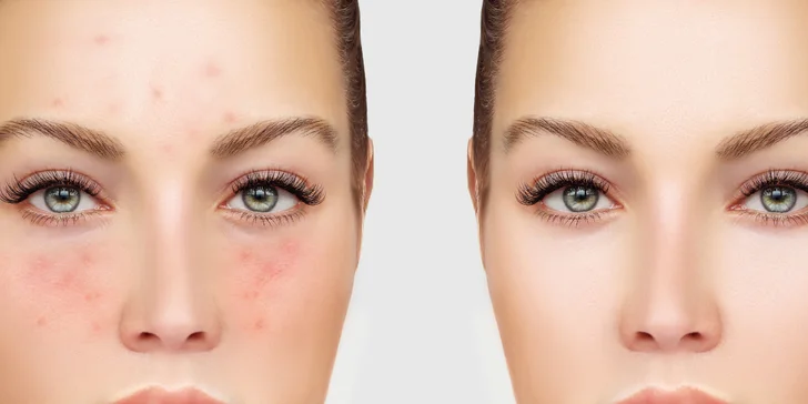 Niekoľko druhov dermatologických procedúr v Interklinik Poprad
