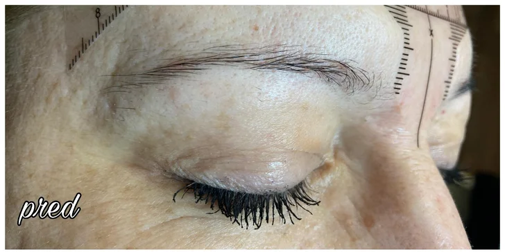 Microblading – dokonale upravené a prirodzené vyzerajúce obočie
