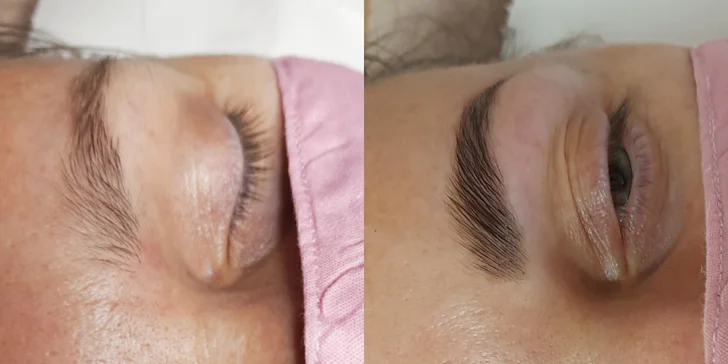 Čistenie pleti, mezoterapia či laminácia obočia v Care and Beauty