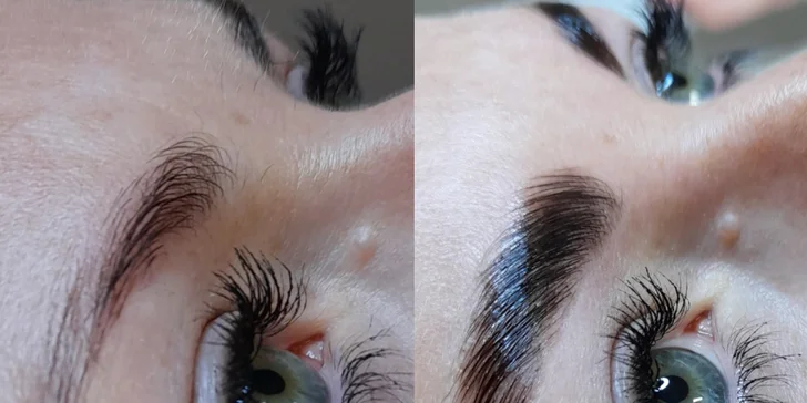 Čistenie pleti, mezoterapia či laminácia obočia v Care and Beauty