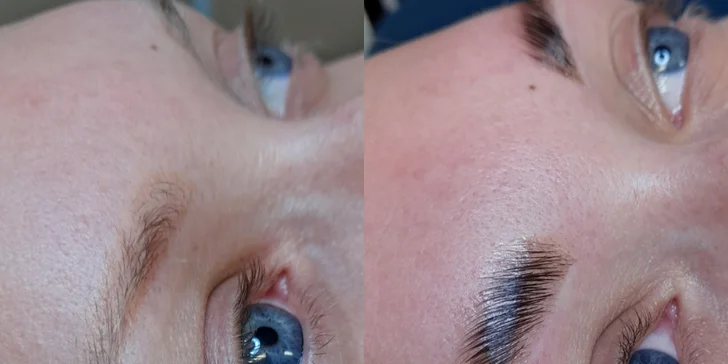Čistenie pleti, mezoterapia či laminácia obočia v Care and Beauty
