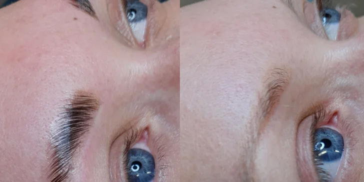 Čistenie pleti, mezoterapia či laminácia obočia v Care and Beauty