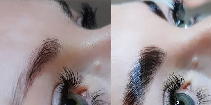 Čistenie pleti, mezoterapia či laminácia obočia v Care and Beauty