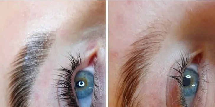 Čistenie pleti, mezoterapia či laminácia obočia v Care and Beauty