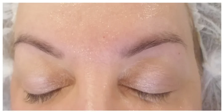 Mikrodermabrazia, laminácia obočia či Lash-Lifting pre vaše riasy