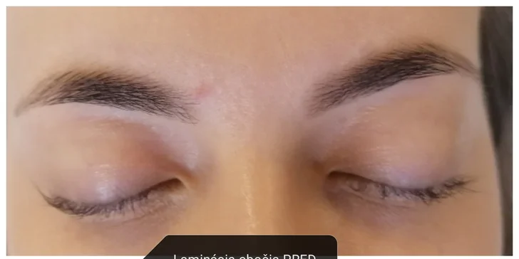 Mikrodermabrazia, laminácia obočia či Lash-Lifting pre vaše riasy