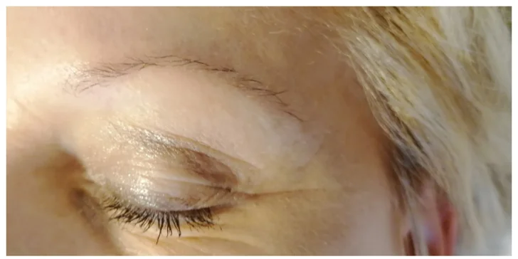 Mikrodermabrazia, laminácia obočia či Lash-Lifting pre vaše riasy