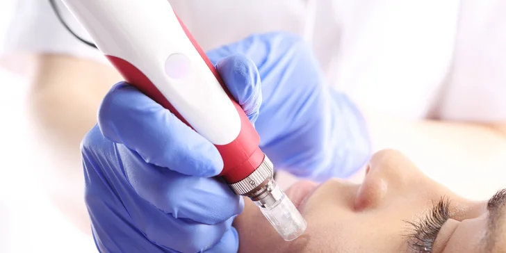 Zbavte sa vrások aj jazvičiek s injekčnou mezoterapiou tváre Dermaheal HSR