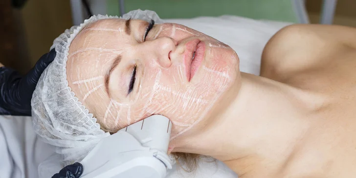 Horný, dolný a celkový facelifting ULTHERA