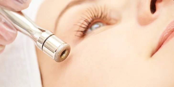 Odstránenie kožných nedostatkov pomocou lasera Sparidonn, anti-aging alebo hĺbkové čistenie, či diamantová mikrodermabrázia
