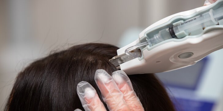 Vlasová mezoterapia a pleťové ošetrenia pomocou prístroja VITAL INJECTOR