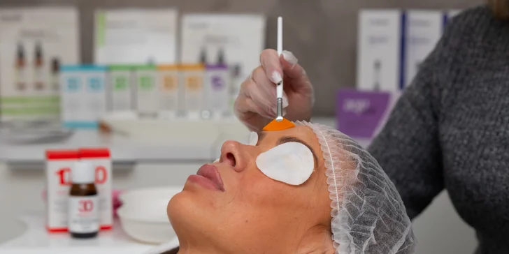 Čistá a mladistvá pleť vďaka chemickému a retinolovému peelingu - samostatné ošetrenia aj permanentky