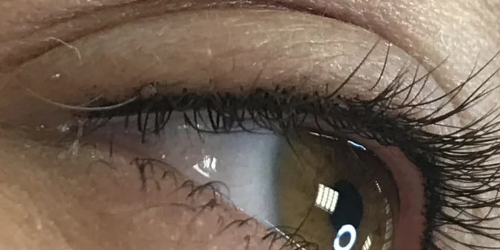 Lash lifting či dokonalé 1D alebo 3D mihalnice
