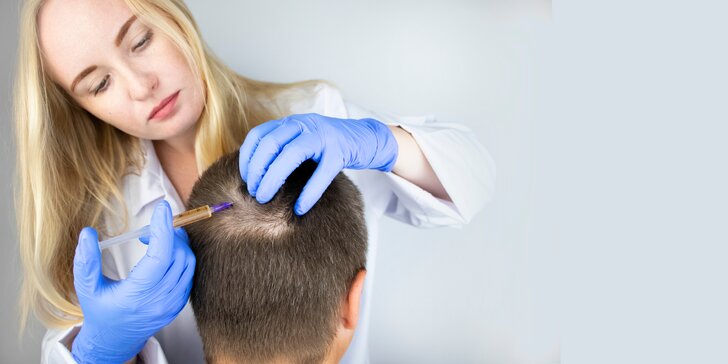 Zastavte nadmerné vypadávanie vlasov s vlasovou mezoterapiou v salóne Assiduo
