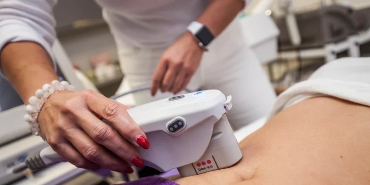 Hifutherapy - nechirurgický lifting tváre či vybraných častí tela