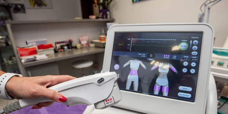 Hifutherapy - nechirurgický lifting tváre či vybraných častí tela