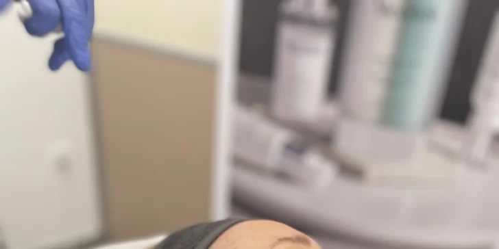 Špeciálny lifting tváre vykonávaný pomocou vstrebateľných nití