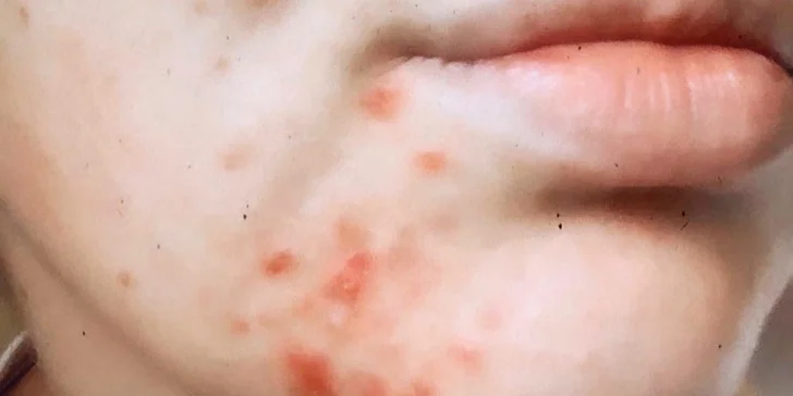 Relaxačná masáž tváre alebo anti akné ošetrenie v salóne Divine