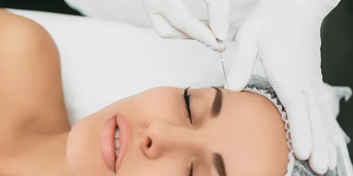 Dajte svojmu pohľadu nový rozmer aplikáciou liftingových nití do okolia očí vo Fabulous beauty