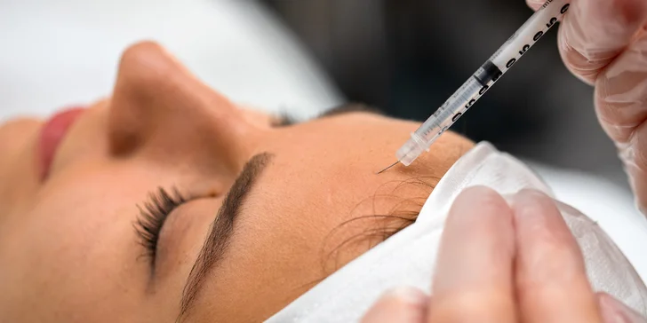 Aplikácia botulotoxínu do čela, medziobočia alebo okolia očí