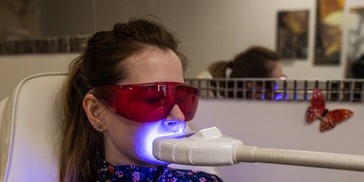 Kompletné a účinné laserové bielenie zubov, aj výhodný balíček pre dvojice