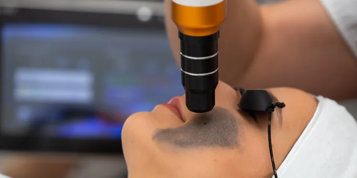 Hollywood peeling: neinvazívne laserové ošetrenie pre krásnu a hladkú pleť