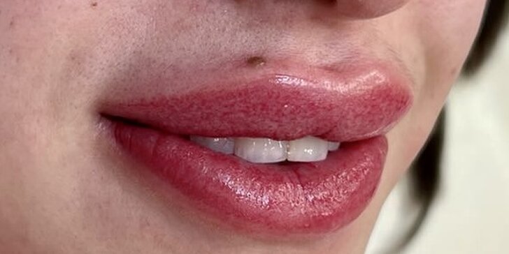 Aquarell lips: Permanentný make-up, ktorý zvýrazni vaše pery