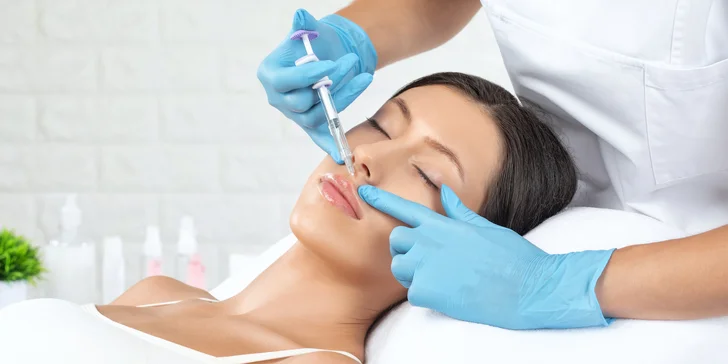 Výplň nosovo-ústnych vrások a korekcia lícnych kostí kyselinou hyalurónovou v salóne Beauty Exklusiv