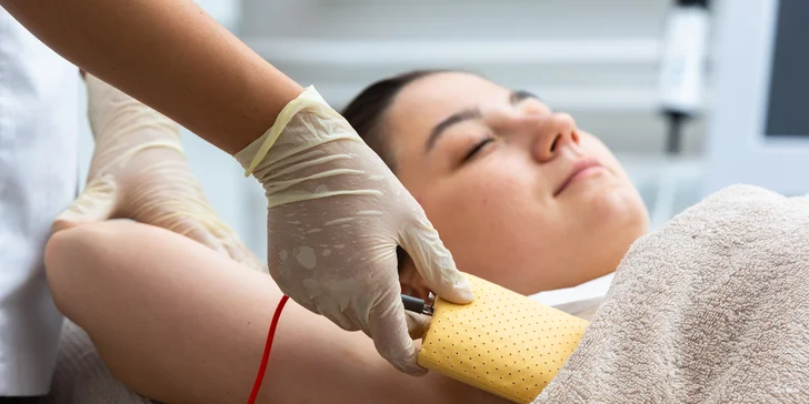 Electro antiperspirant: Zbavte sa nadmerného potenia pomocou ionoforézy