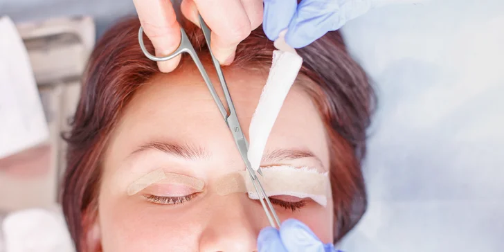 Blefaroplastika: Korekcia horných viečok v Magnifica Clinic