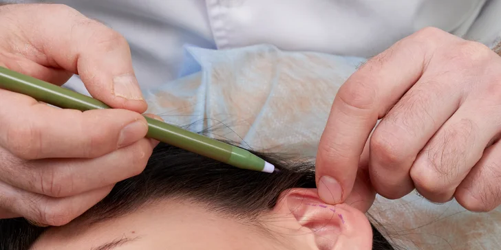 Chirurgická korekcia odstávajúcich uší v modernej klinike Magnifica Clinic