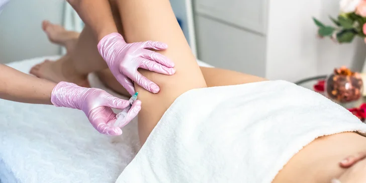 Zbavte sa celulitídy pomocou mezoterapie alebo injekčnej techniky v salóne DermaFresh