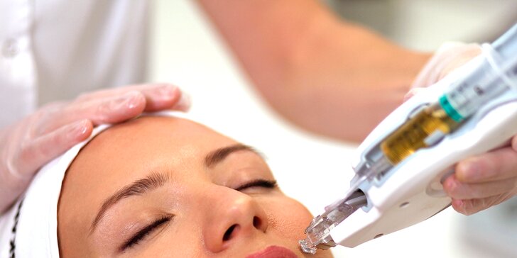 Omladnite a revitalizujte svoje vlasy s účinnou mezoterapiou v Toskani Beauty Center