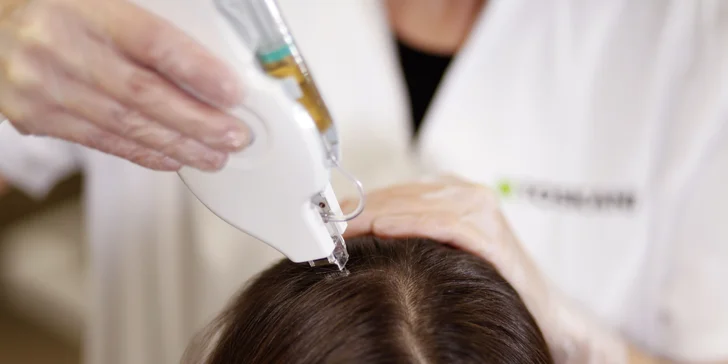 Omladnite a revitalizujte svoje vlasy s účinnou mezoterapiou v Toskani Beauty Center