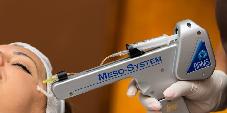 Mezoterapia tváre mezoterapeutickou pištoľou Vital Injector v Gold Studio
