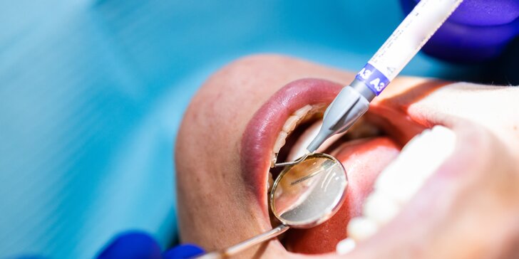 Dentini: Dentálna hygiena pre deti aj dospelých alebo bielenie zubov