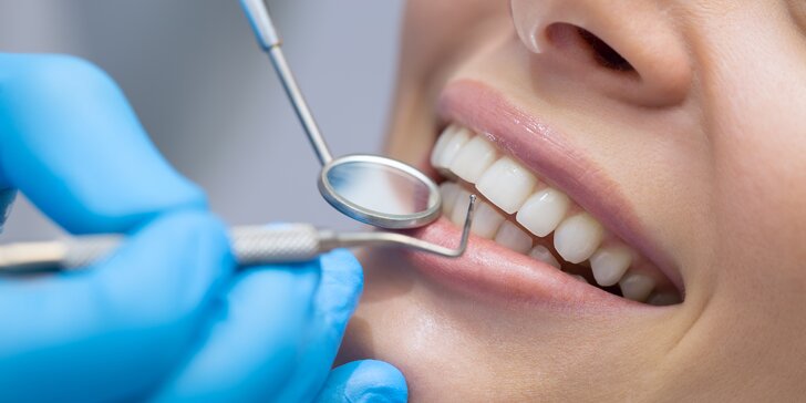 Dentálna hygiena či ambulantné bielenie zubov