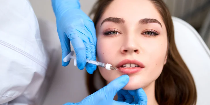 Výplň vrások alebo zvýraznenie pier kyselinou hyalurónovou v Scarlett clinic