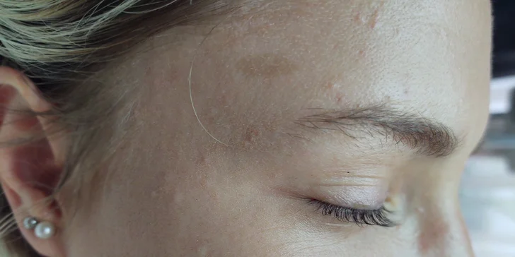 Lash lifting, farbenie mihalníc aj laminácia obočia