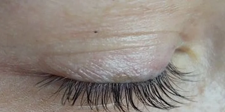 Lash lifting, farbenie mihalníc aj laminácia obočia