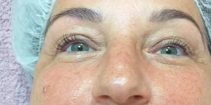 Lash Lifting alebo základné či kompletné čistenie pleti