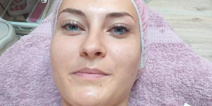 Lash Lifting alebo základné či kompletné čistenie pleti