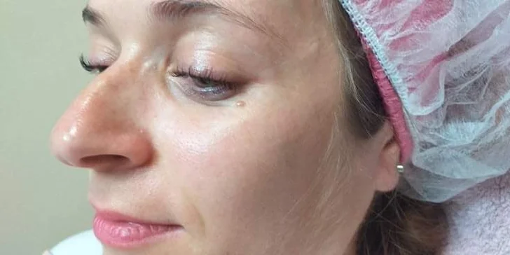 Lash Lifting alebo základné či kompletné čistenie pleti