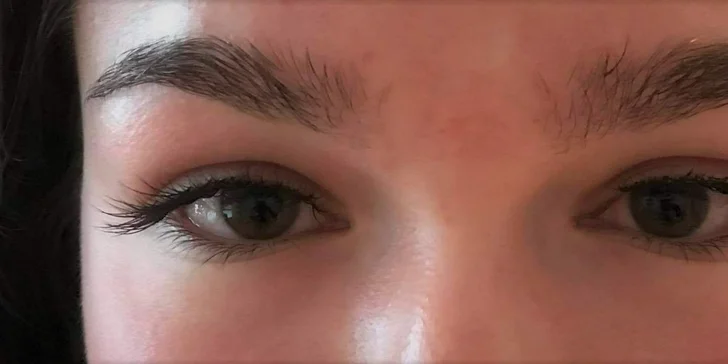 Aplikácia nových 3D mihalníc alebo ich doplnenie